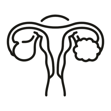 PCOS_PCOD
